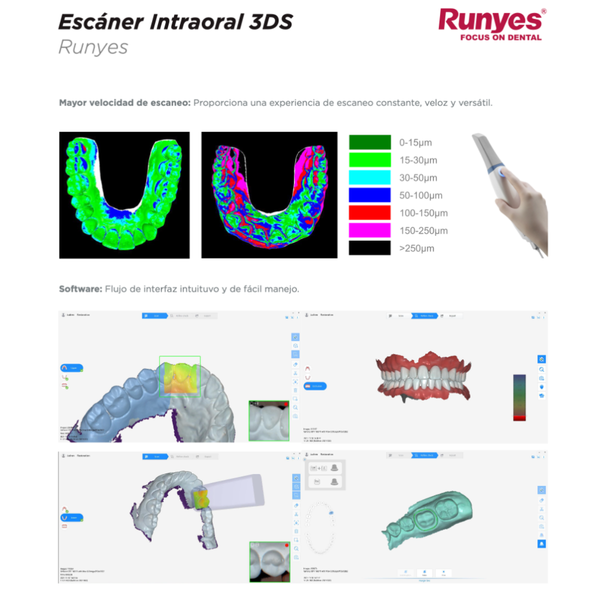 Scanner Escaner Intraoral Dental Runyes 3ds