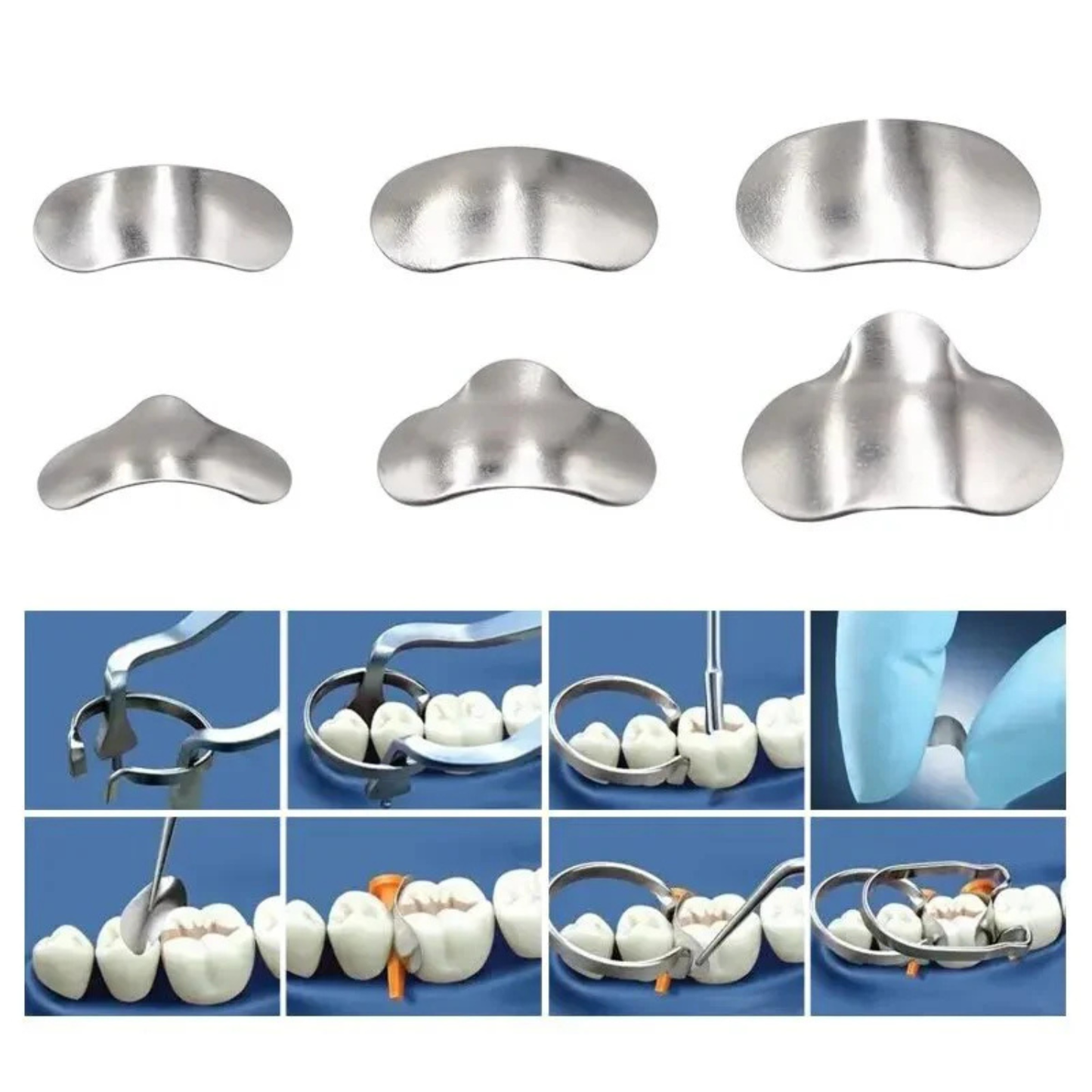 Matrices Dentales Banda Matriz Y Anillos 100 Piezas