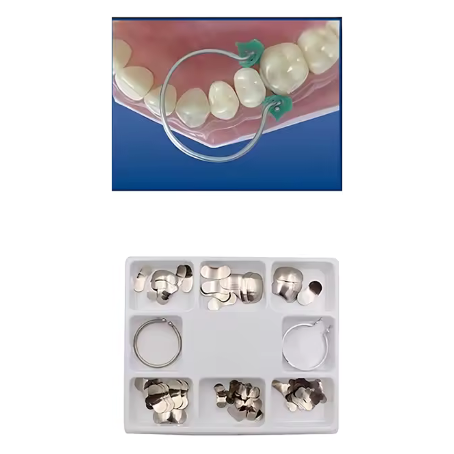 Matrices Dentales Banda Matriz Y Anillos 100 Piezas